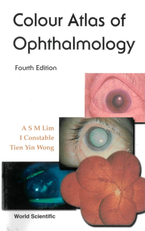 Cover image for book Colour Atlas of Ophthalmology