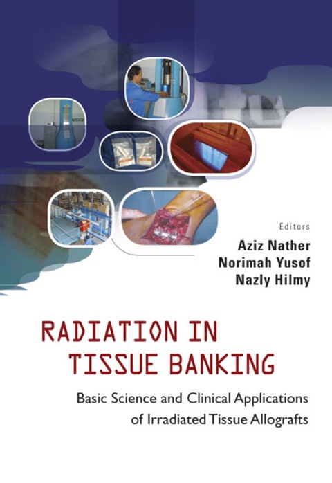 Cover image for book Radiation in Tissue Banking: Basic Science and Clinical Applications of Irradiated Tissue Allografts