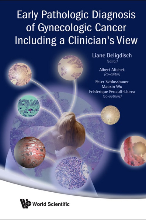 Cover image for book Early Pathologic Diagnosis of Gynecologic Cancer Including a Clinician's View