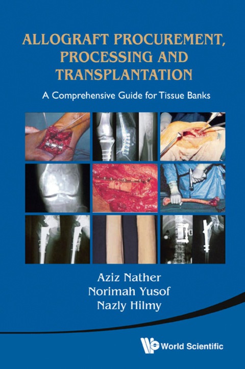 Cover image for book Allograft Procurement, Processing and Transplantation: A Comprehensive Guide for Tissue Banks