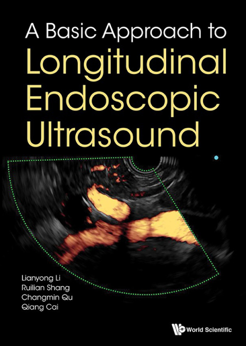 Cover image for book A Basic Approach to Longitudinal Endoscopic Ultrasound