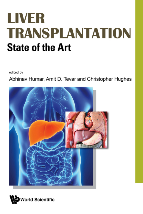 Cover image for book Liver Transplantation: State of the Art