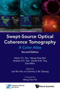 Imagen de portada: Swept-source Optical Coherence Tomography: A Color Atlas (Second Edition) 2nd edition 9789813271777