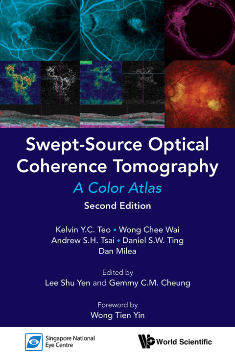 Cover image for book Swept-Source Optical Coherence Tomography: A Color Atlas