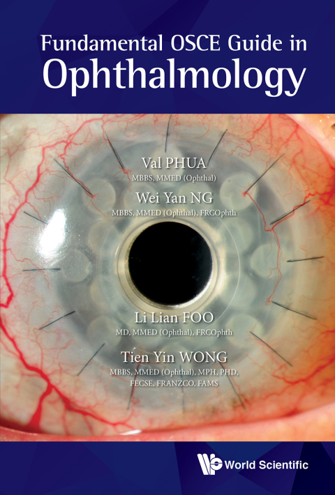 Cover image for book Fundamental OSCE Guide in Ophthalmology