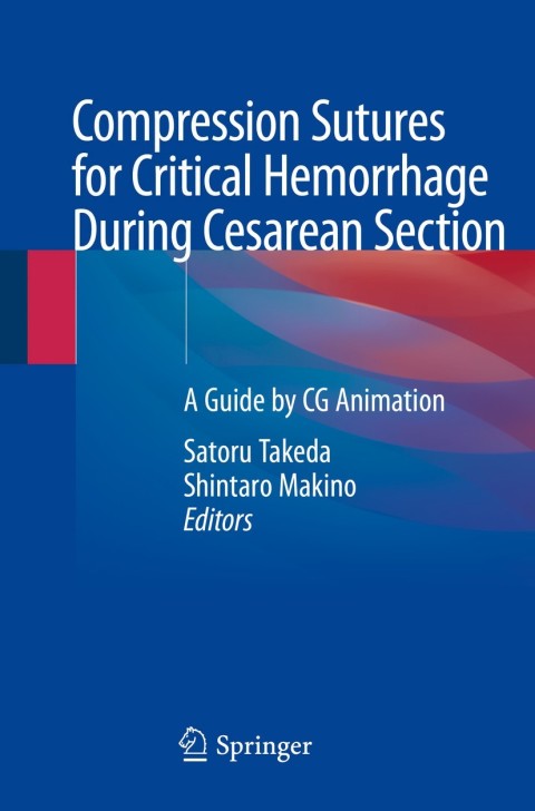Cover image for book Compression Sutures for Critical Hemorrhage During Cesarean Section