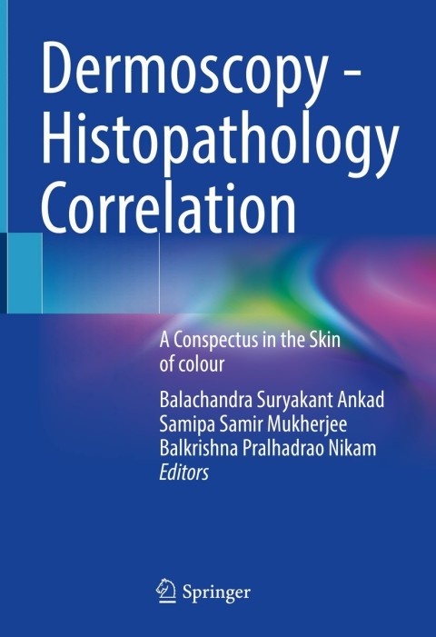 Cover image for book Dermoscopy - Histopathology Correlation