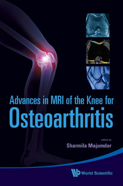 Cover image for book Advances In Mri Of The Knee For Osteoarthritis