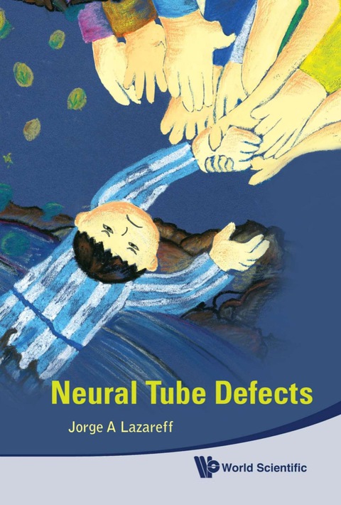 Cover image for book Neural Tube Defects