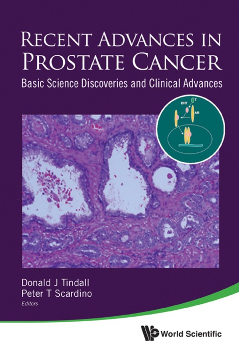 Cover image for book RECENT ADVANCES IN PROSTATE CANCER