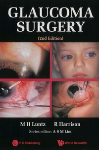 Cover image: GLAUCOMA SURGERY (2ND EDITION) 2nd edition 9789810214180