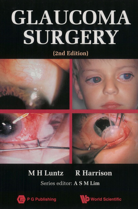 Cover image for book GLAUCOMA SURGERY (2ND EDITION)