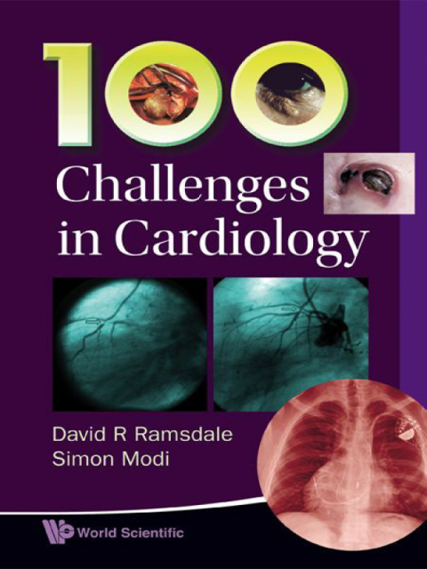 Cover image for book 100 Challenges in Cardiology
