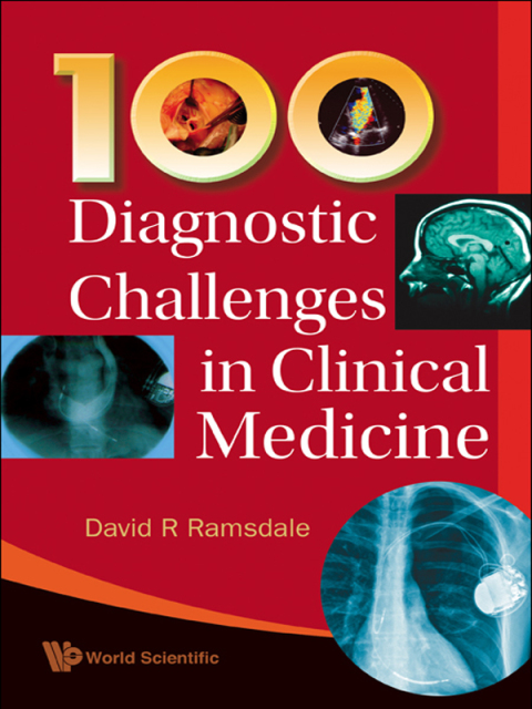 Cover image for book 100 Diagnostic Challenges in Clinical Medicine
