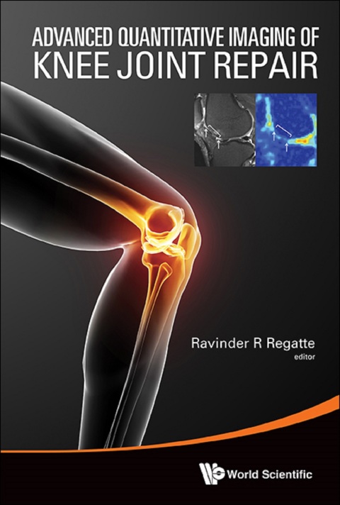 Cover image for book Advanced Quantitative Imaging of Knee Joint Repair