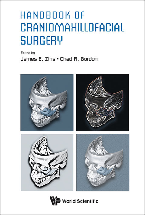 Cover image for book Handbook of Craniomaxillofacial Surgery