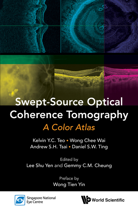 Cover image for book Swept-Source Optical Coherence Tomography: A Color Atlas