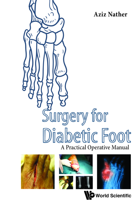 Cover image for book Surgery for Diabetic Foot: A Practical Operative Manual