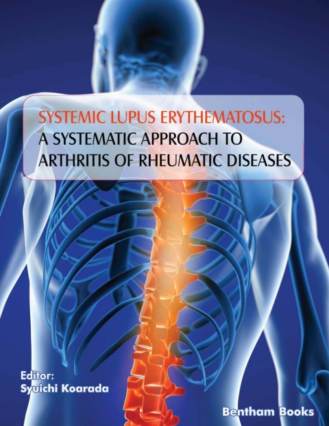 Cover image for book Systemic Lupus Erythematosus: A Systematic Approach to Arthritis of Rheumatic Diseases: Volume 4