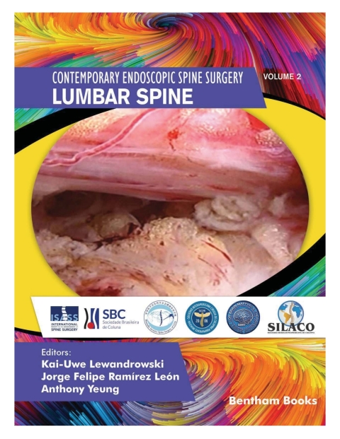 Cover image for book Lumbar Spine