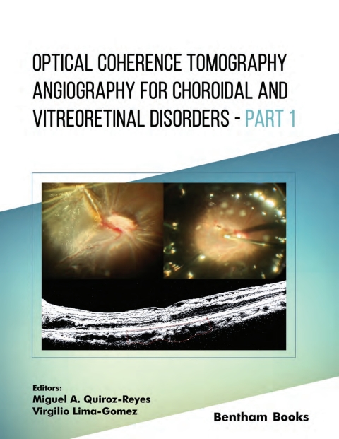 Cover image for book Optical Coherence Tomography Angiography for Choroidal and Vitreoretinal Disorders – Part 1
