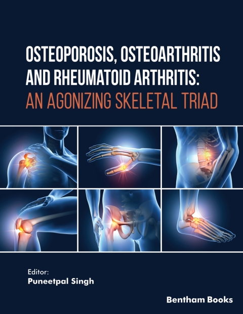 Cover image for book Osteoporosis, Osteoarthritis and Rheumatoid Arthritis: An Agonizing Skeletal Triad