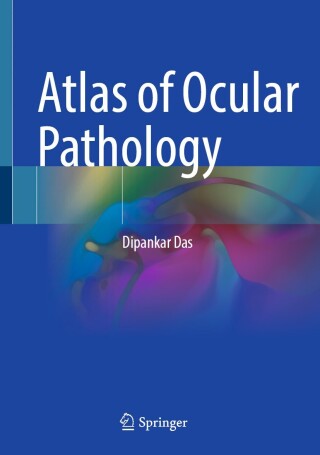 Atlas of Ocular Pathology