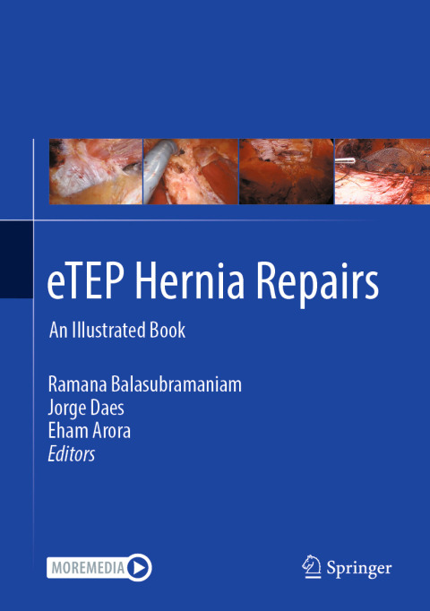 Cover image for book eTEP Hernia Repairs