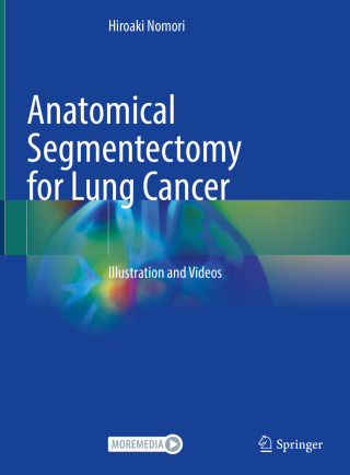 Anatomical Segmentectomy for Lung Cancer