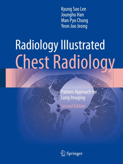 Cover image for book Radiology Illustrated: Chest Radiology
