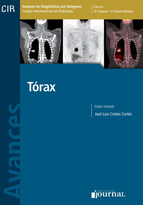 Cover image for book Avances en diagnóstico por imágenes: Torax