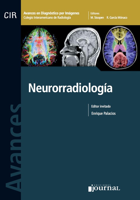 Avances en diagnóstico por imágenes: Neurorradiología