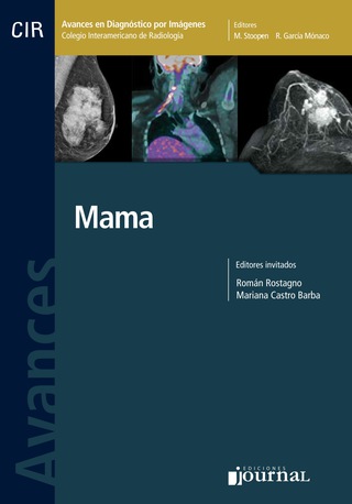 Avances en el diagnóstico por imágenes: Mama