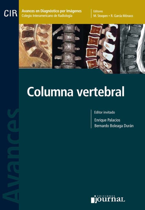 Avances en diagnóstico por imágenes: Columna vertebral