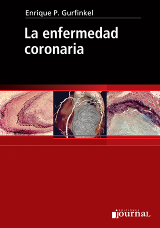 La enfermedad coronaria