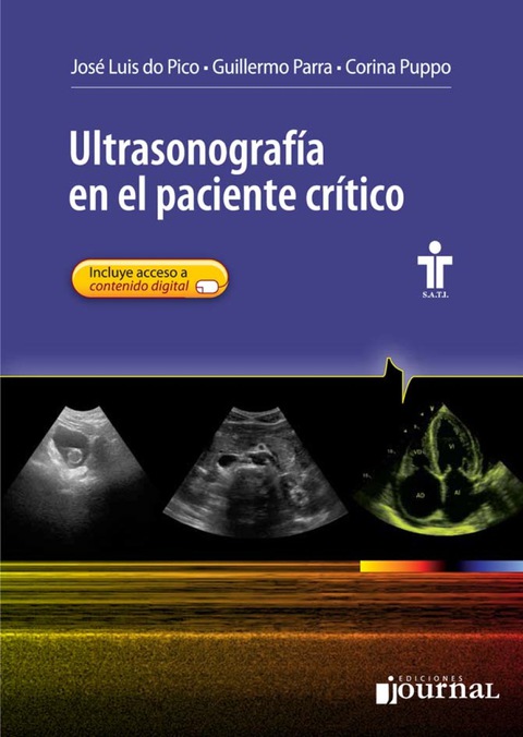 Cover image for book Ultrasonografía en el paciente crítico