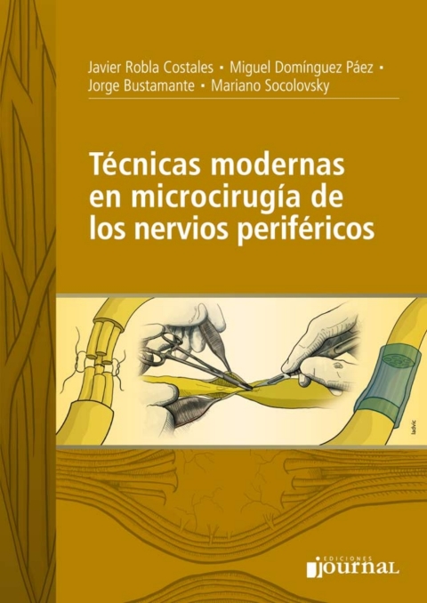 Técnicas modernas en microcirugía de los nervios periféricos