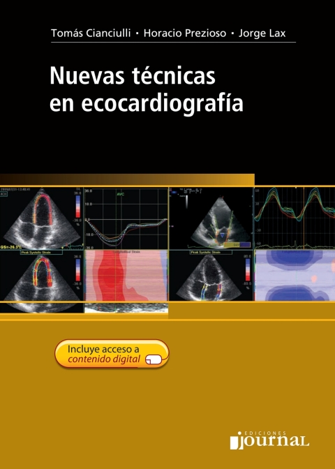 Cover image for book Nuevas técnicas en ecocardiografía