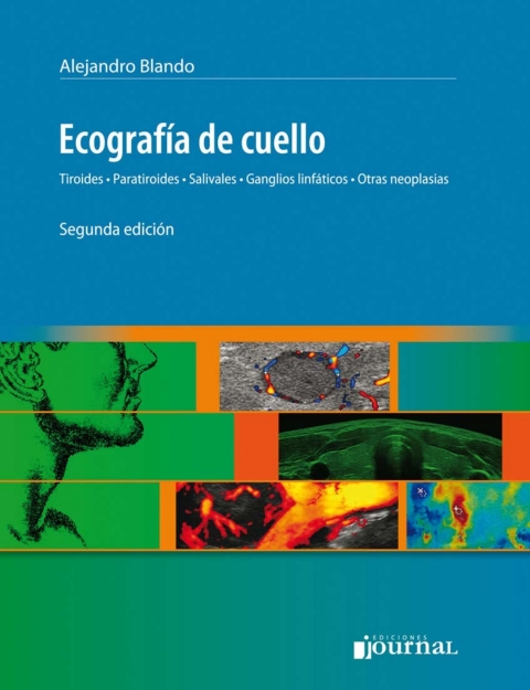 Ecografía de cuello, tiroides, paratiroides, salivales, ganglios linfáticos, otras neoplasisas