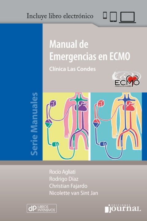 Manual de emergencias en ECMO