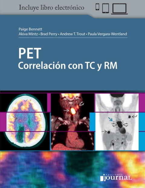 Cover image for book PET: Correlación con TC y RM