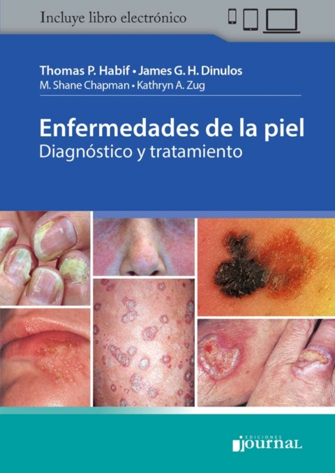 Cover image for book Enfermedades de la piel: Diagnóstico y tratamiento