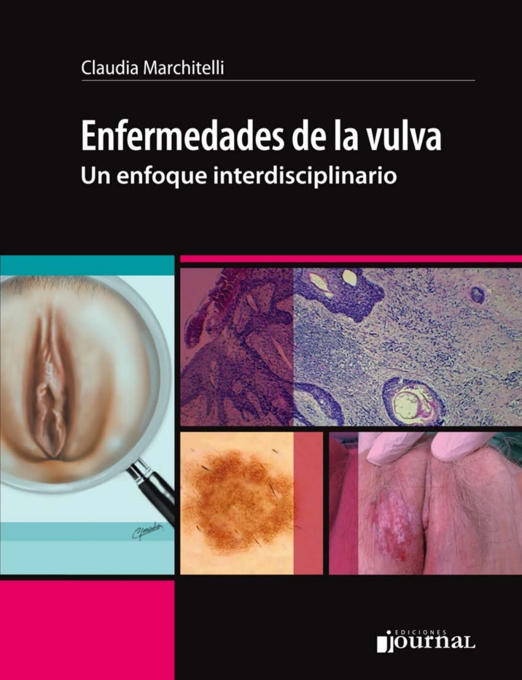 Page Fidelity Enfermedades de la vulva; $29.10
