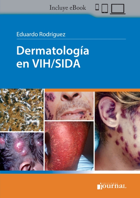 Cover image for book Dermatología en VIH/Sida