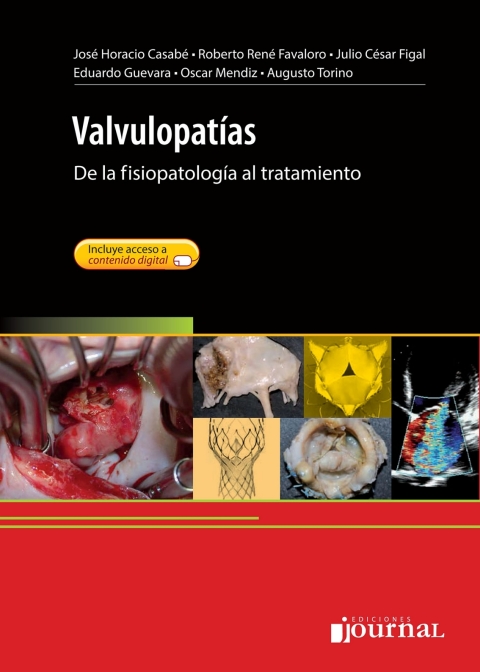 Cover image for book Valvulopatías
