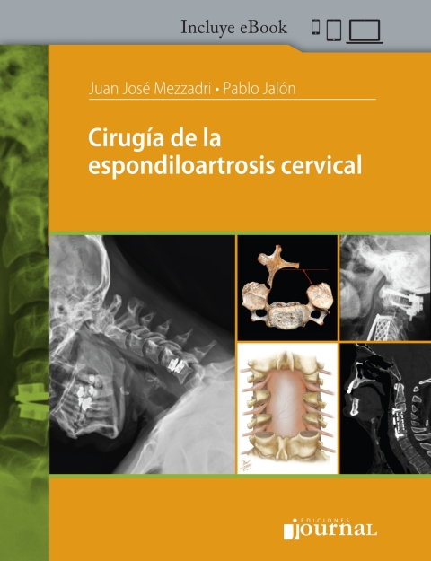 Cover image for book Cirugía de la espondiloartrosis cervical