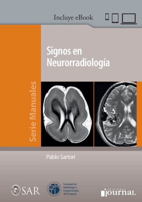 Cover image for book Signos en Neurorradiología