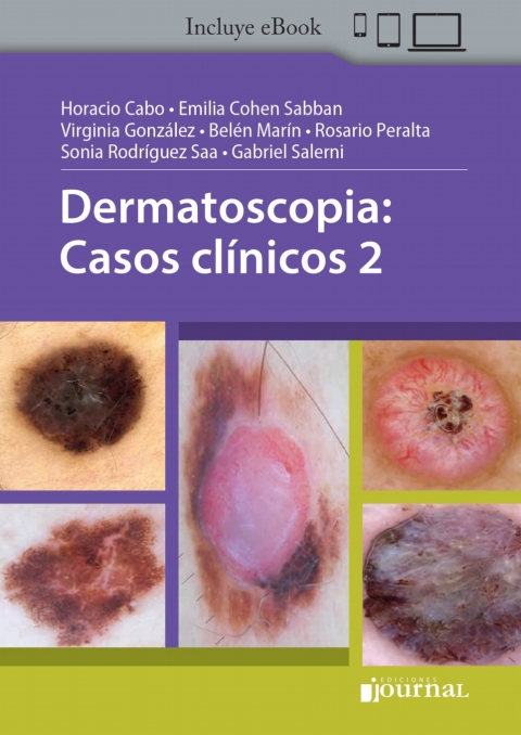 Cover image for book Dermatoscopia: Casos clínicos 2