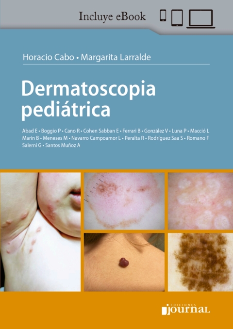 Cover image for book Dermatoscopia pediátrica