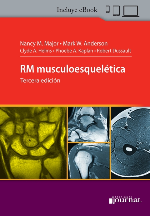 Cover image for book Resonancia magnética musculoesquelética